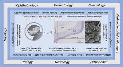 Preparation of human amniotic membrane for transplantation in different application areas